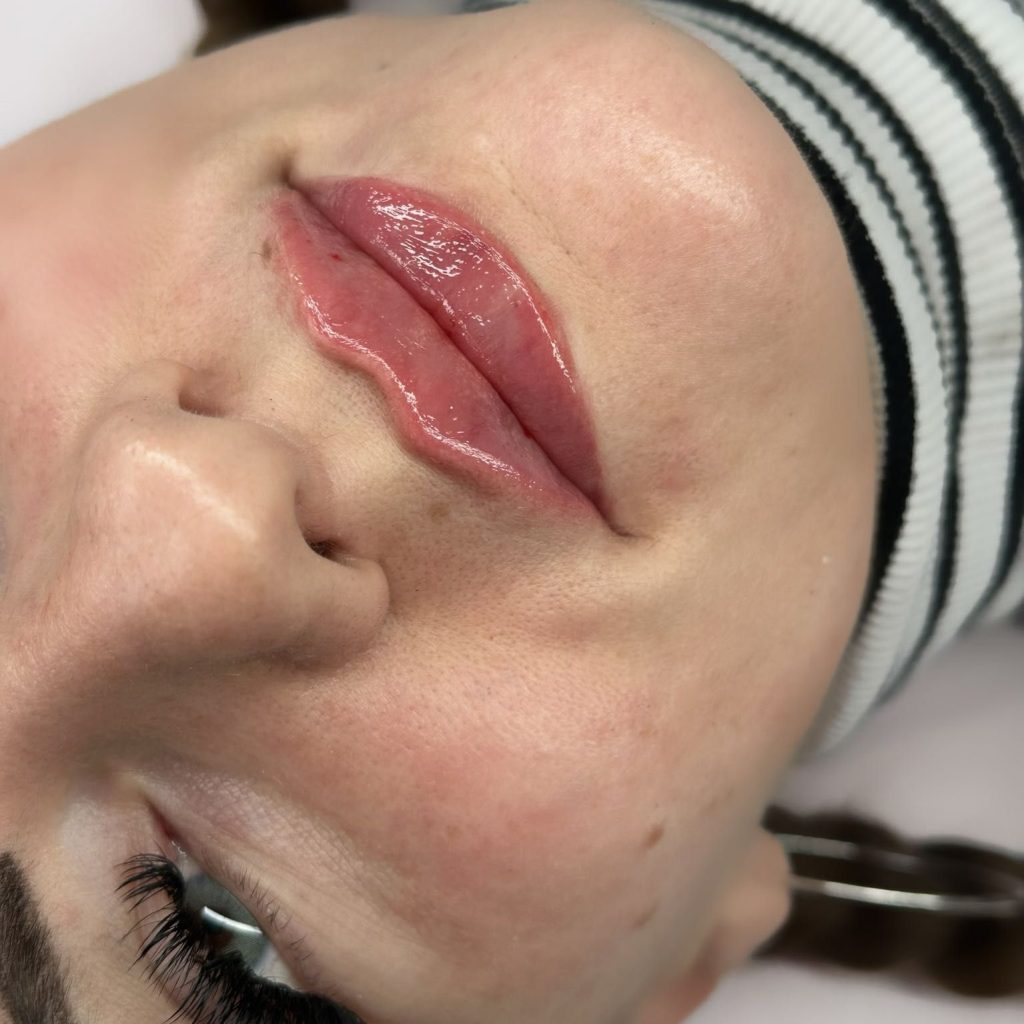 Modelowanie ust – naturalny kształt